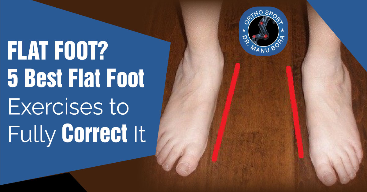 FLAT FOOT ? 5 BEST FLAT FOOT EXERCISES TO FULLY CORRECT IT